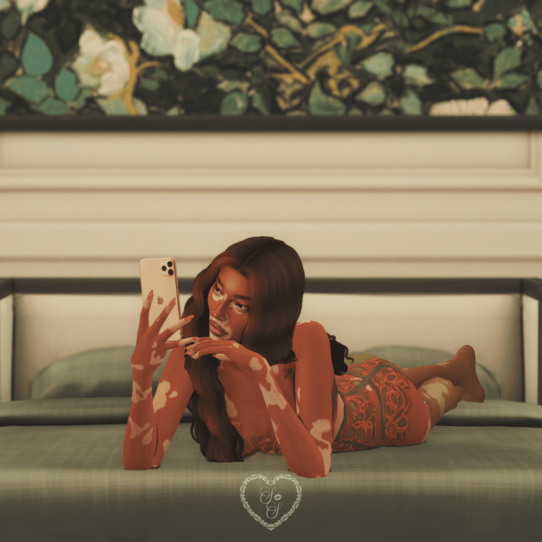 Sim lounging on a bed with an iPhone in hand, wearing lacy lingerie with bold vitiligo skin detail, inspired by Winnie Harlow.