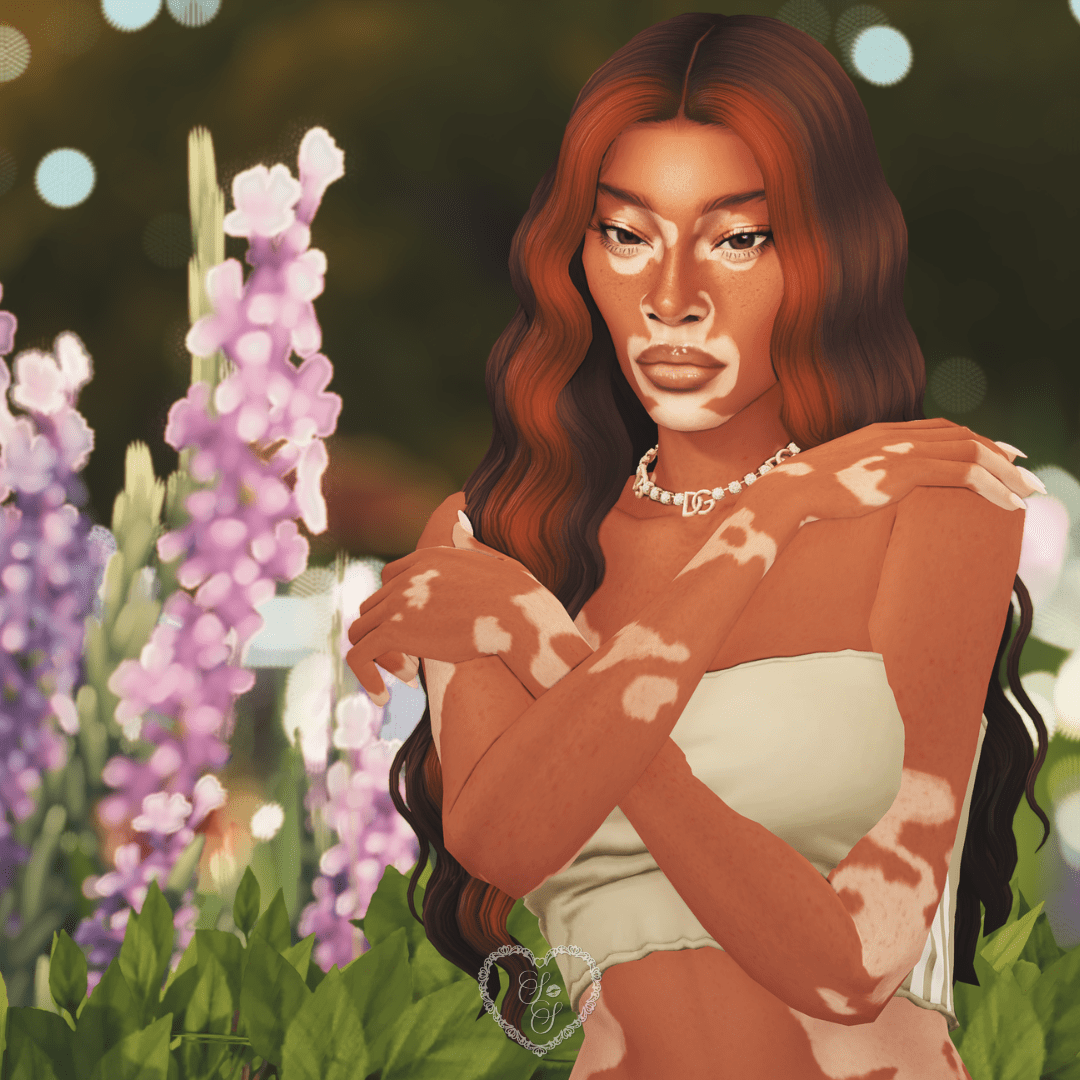 Close-up of a Sims 4 sim inspired by Winnie Harlow, posing with arms crossed in a blooming flower garden.